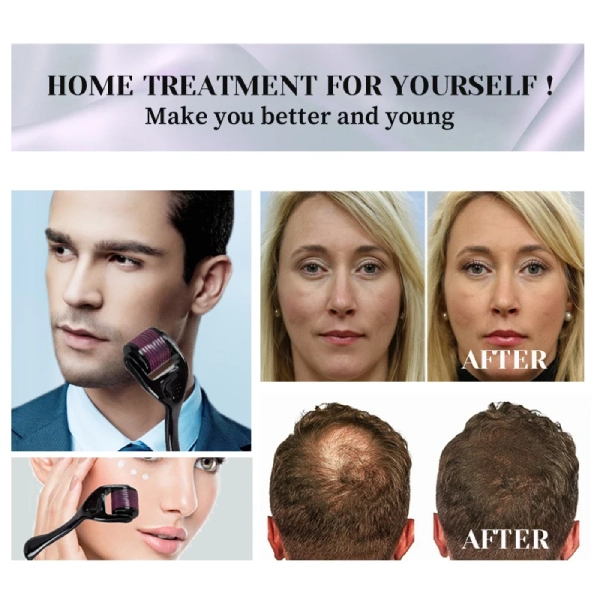 Derma Roller pour la Croissance des Cheveux et de la Barbe 540 Titanium MicroNidle – Image 3